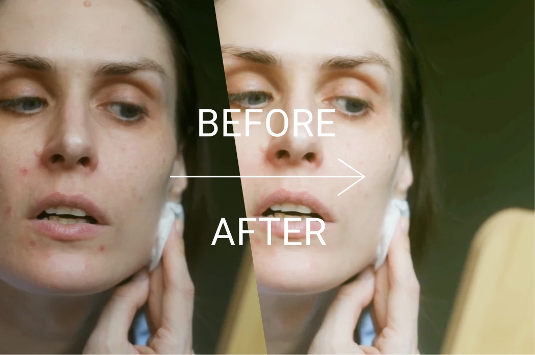 動画 BeforeAfter